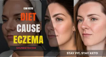 Keto Diet and Eczema: Unraveling the Potential Skin Connection