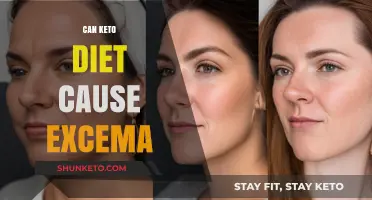 Keto Diet and Eczema: Unraveling the Potential Skin Connection
