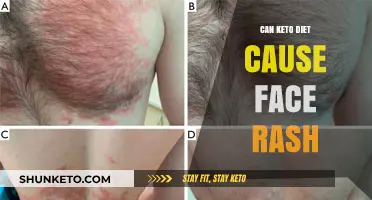Keto Diet and Skin: Understanding the Link to Facial Rashes