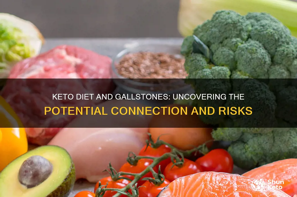 can keto diet cause gallstones