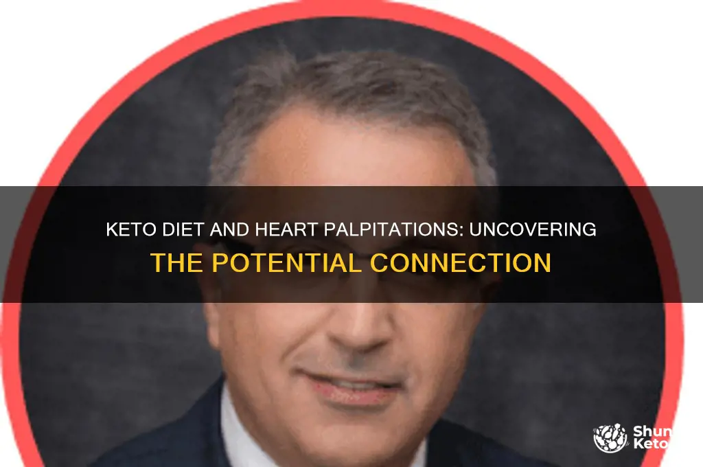 can keto diet cause heart palpitations