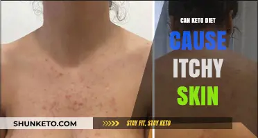 Keto Diet and Itchy Skin: Unraveling the Connection and Solutions