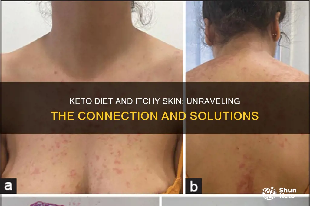 can keto diet cause itchy skin