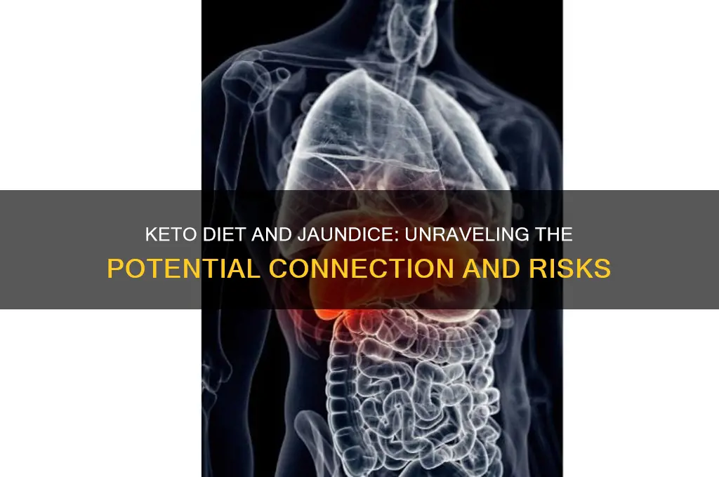 can keto diet cause jaundice
