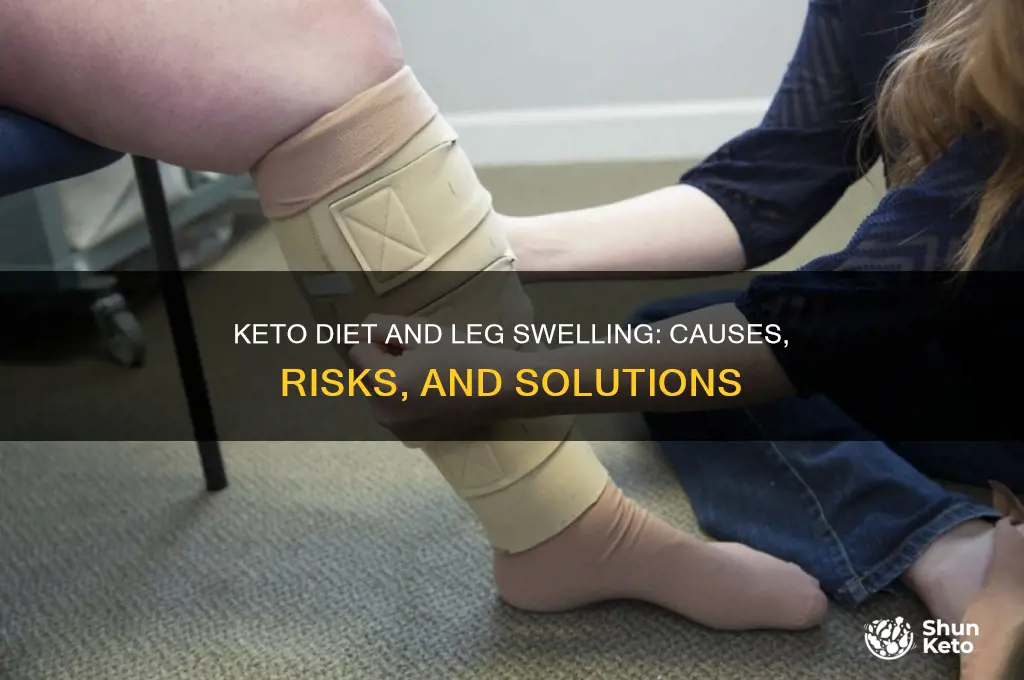 can keto diet cause leg swelling