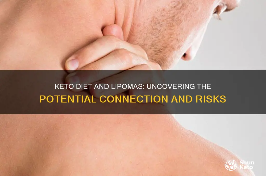 can keto diet cause lipomas