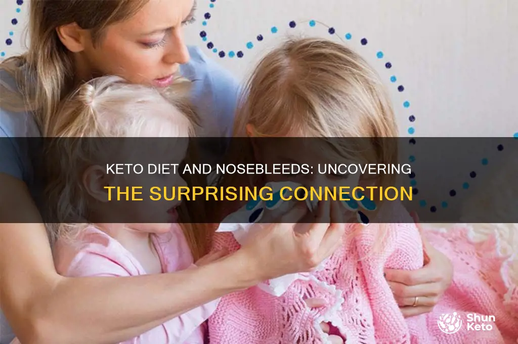 can keto diet cause nosebleeds