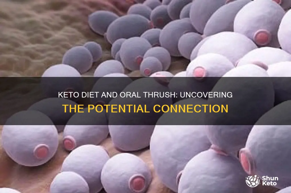 can keto diet cause oral thrush
