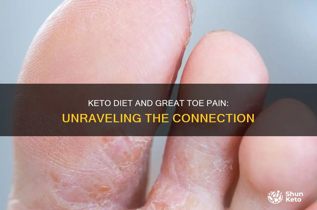 can keto diet cause pain in great toe