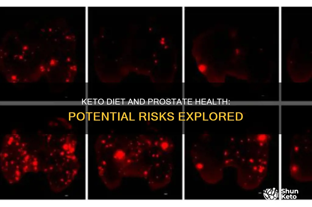 can keto diet cause prostate problems