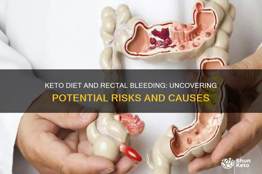 can keto diet cause rectal bleeding