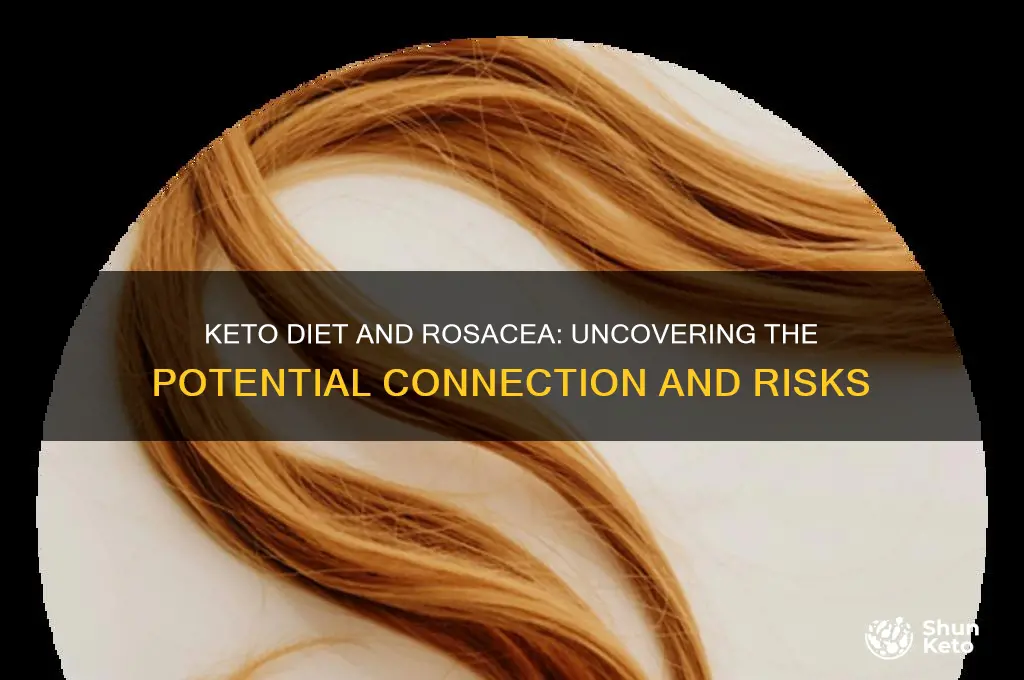 can keto diet cause rosacea