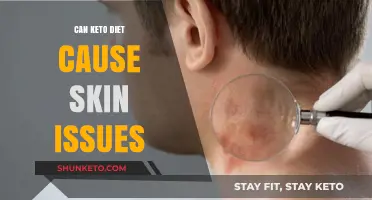 Keto Diet and Skin Health: Uncovering Potential Issues and Solutions