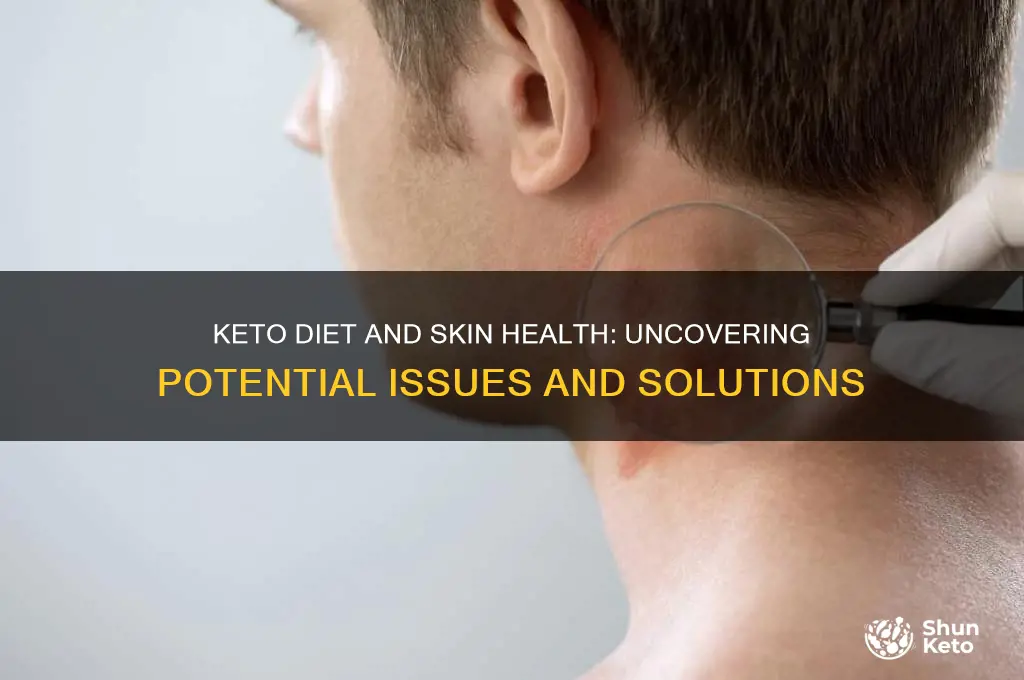 can keto diet cause skin issues
