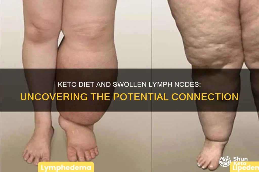 can keto diet cause swollen lymph nodes