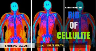 Can Keto Diet Reduce Cellulite? Facts and Myths Explained