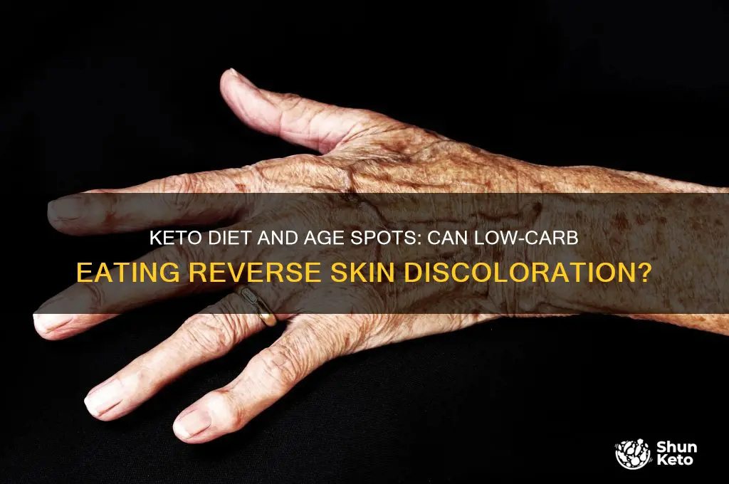 can keto diet help reverse age spots