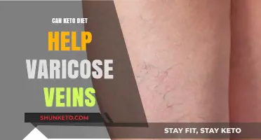 Keto Diet and Varicose Veins: Exploring Potential Benefits and Risks