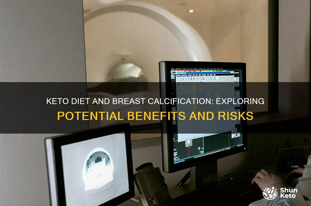 can keto diet help wit breast calcification