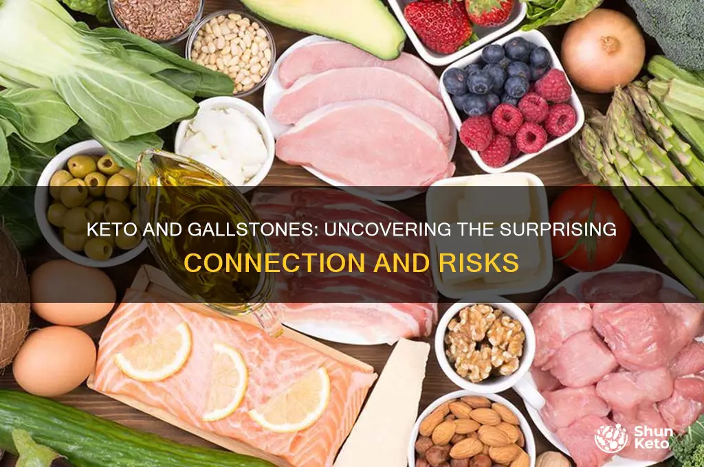can keto give you gallstones