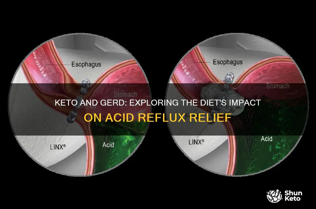 can keto help gerd