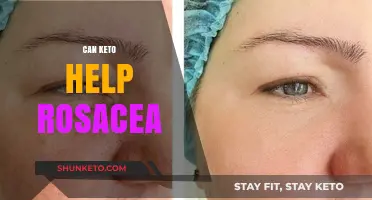 Keto Diet and Rosacea: Exploring Potential Benefits for Skin Health