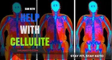 Keto Diet and Cellulite: Can Low-Carb Eating Reduce Skin Dimples?
