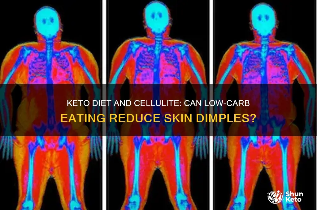can keto help with cellulite