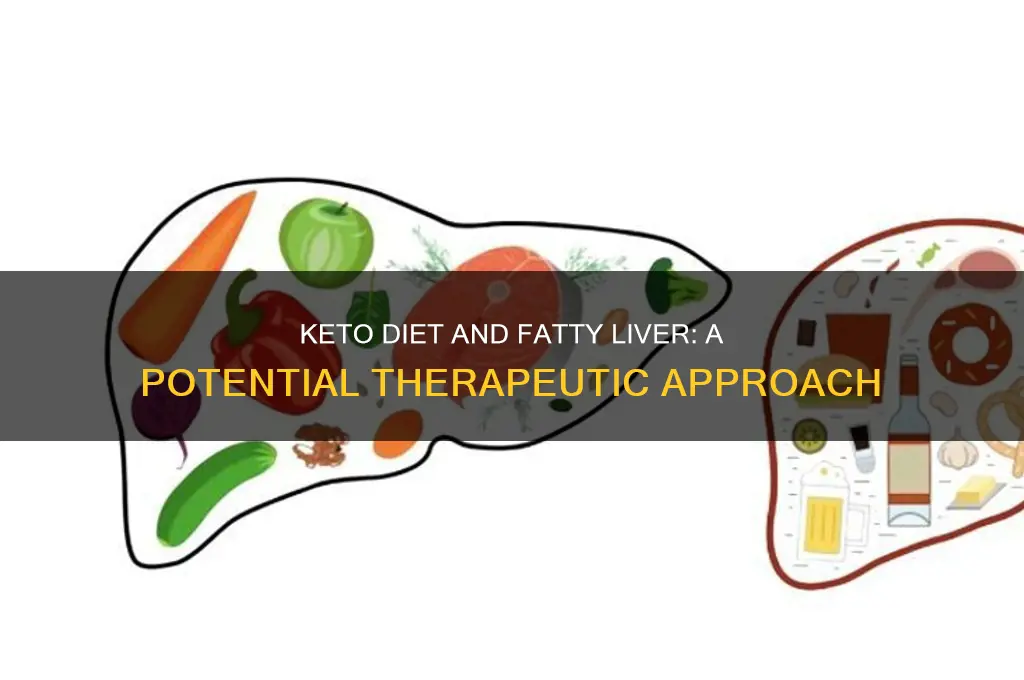 can keto help with fatty liver