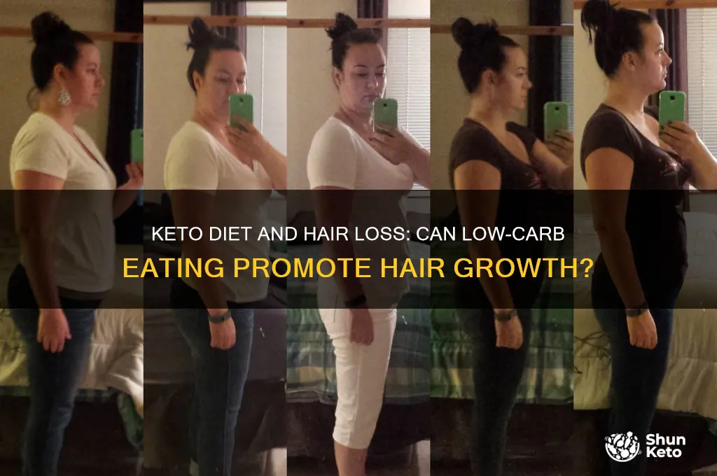 can keto help with hair loss