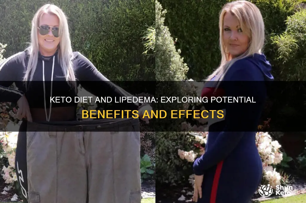 can keto help with lipodema