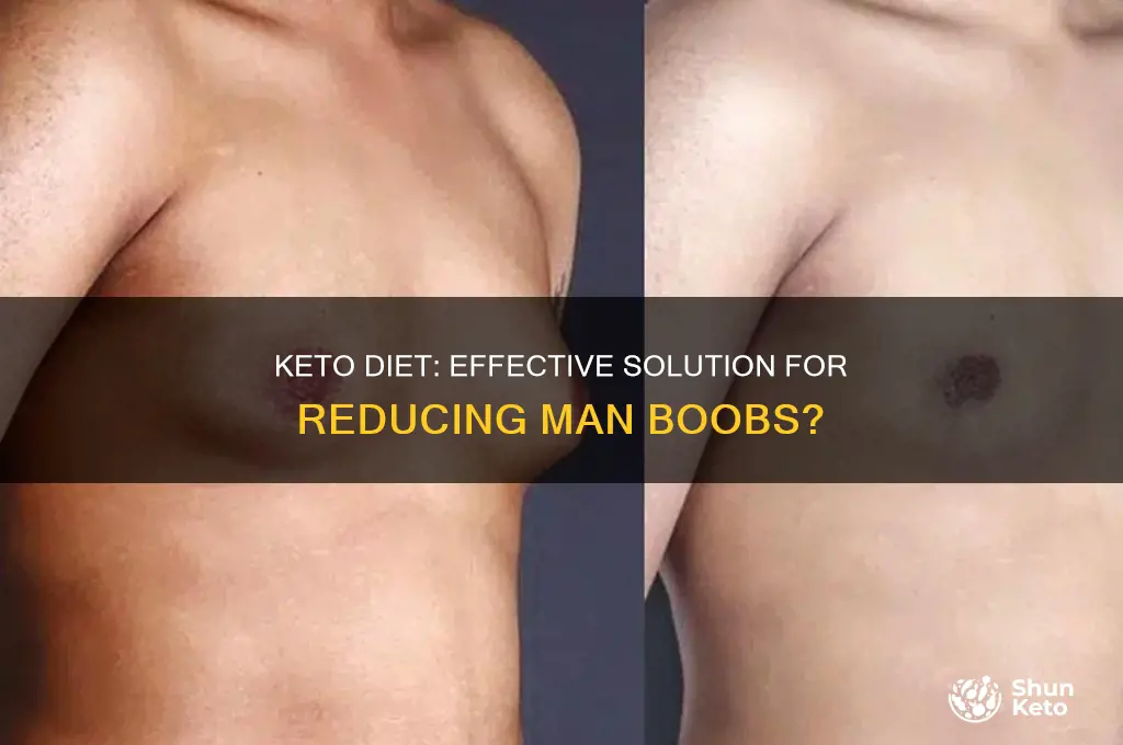 can keto help with man boobs