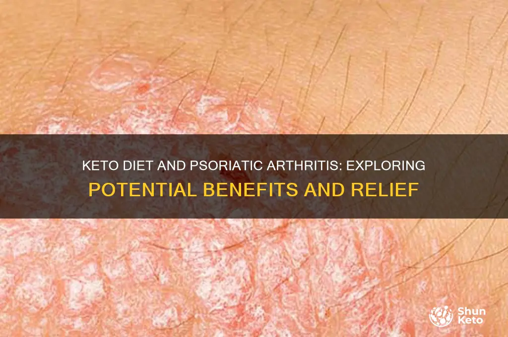 can keto help with psoriatic arthritis