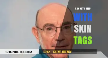 Keto Diet and Skin Tags: Exploring Potential Benefits and Effects