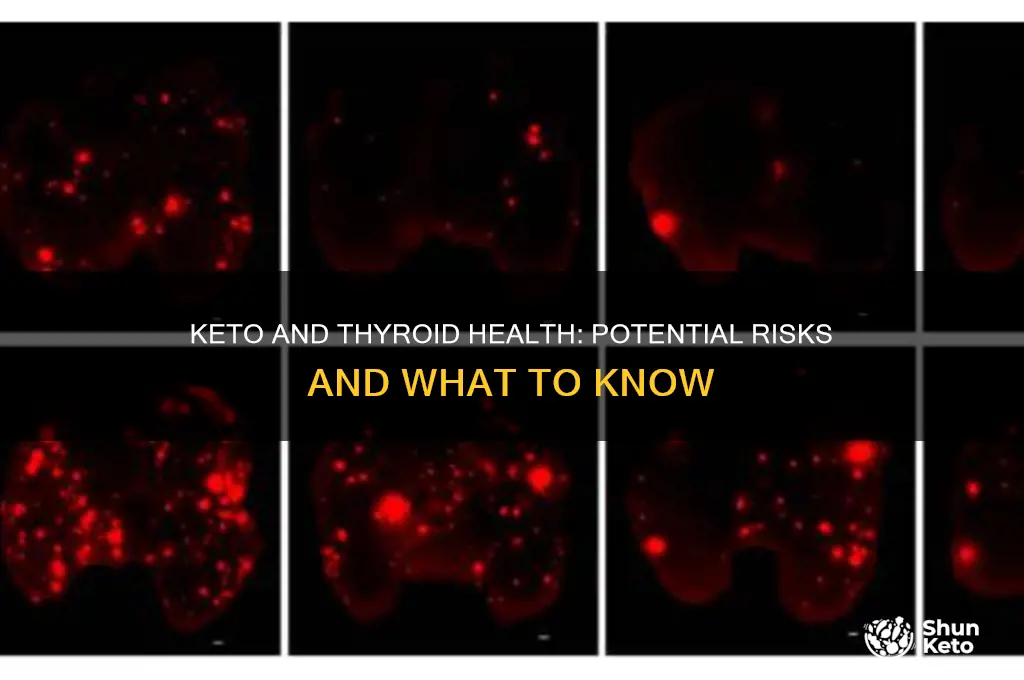 can keto mess up your thyroid