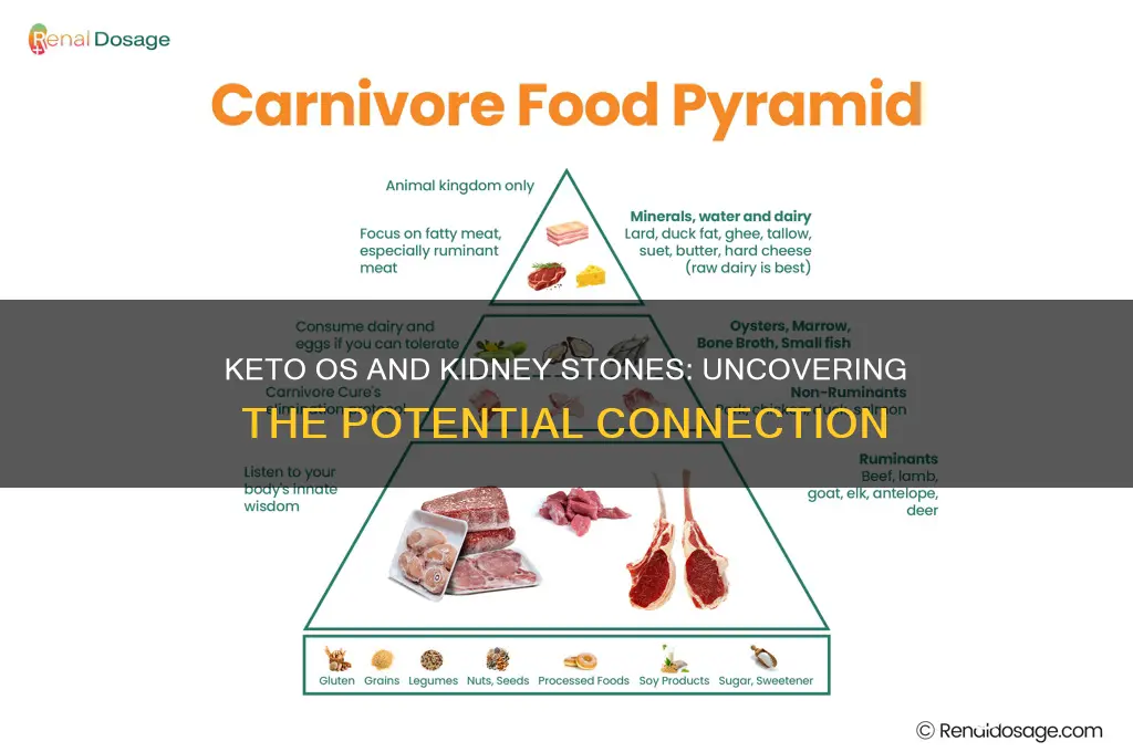 can keto os cause kidney stones
