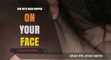 Can Keto Rash Appear on Your Face? Symptoms and Solutions