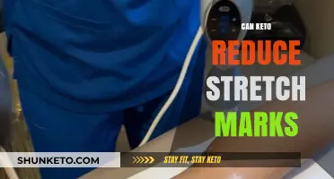 Keto Diet and Stretch Marks: Can Low-Carb Eating Help?