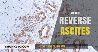 Can Keto Reverse Ascites? Exploring the Diet's Impact on Fluid Buildup