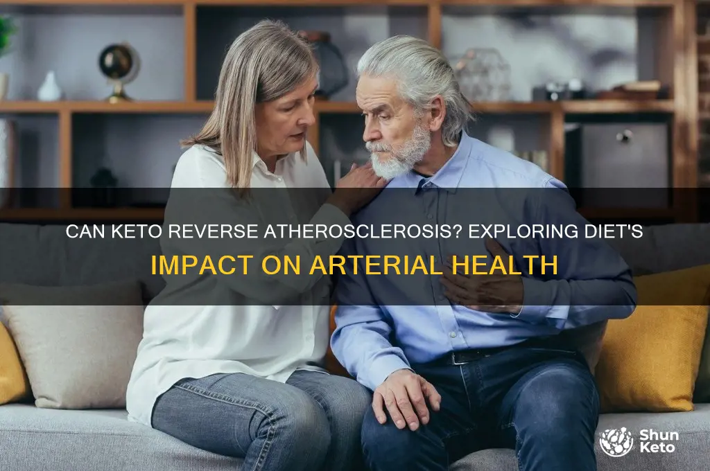 can keto reverse atherosclerosis
