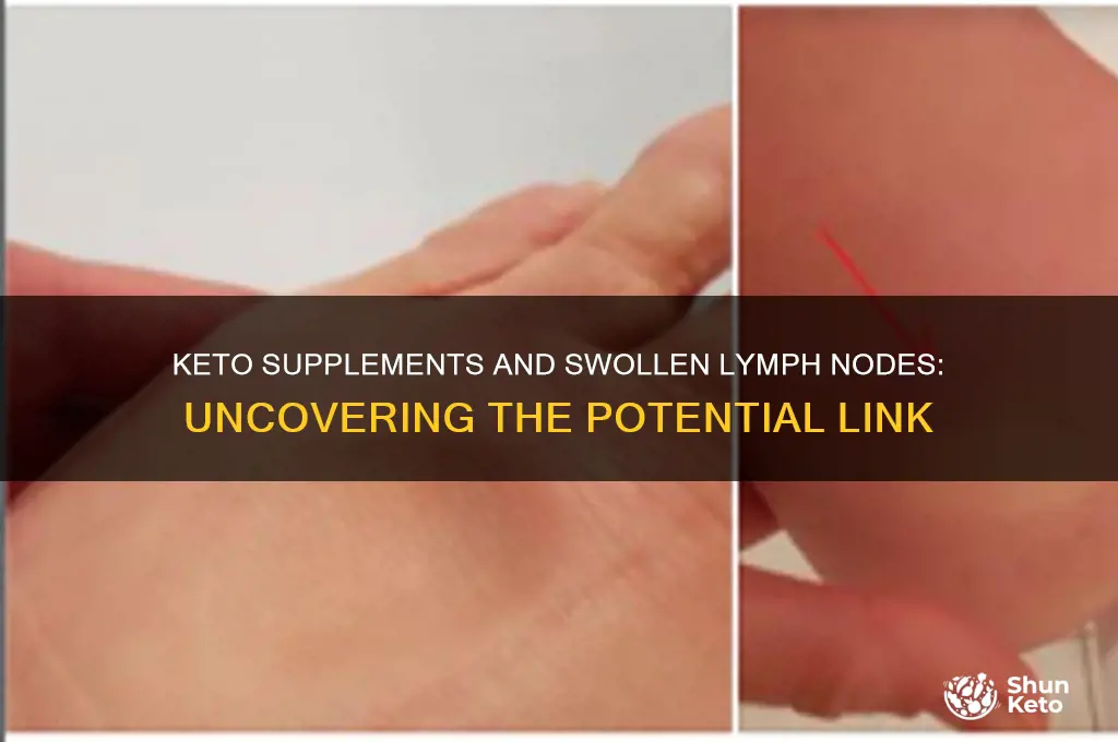 can keto supplements cause lymph nodes to swell