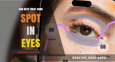 Keto Diet and Eye Health: Can It Treat Dark Spots?