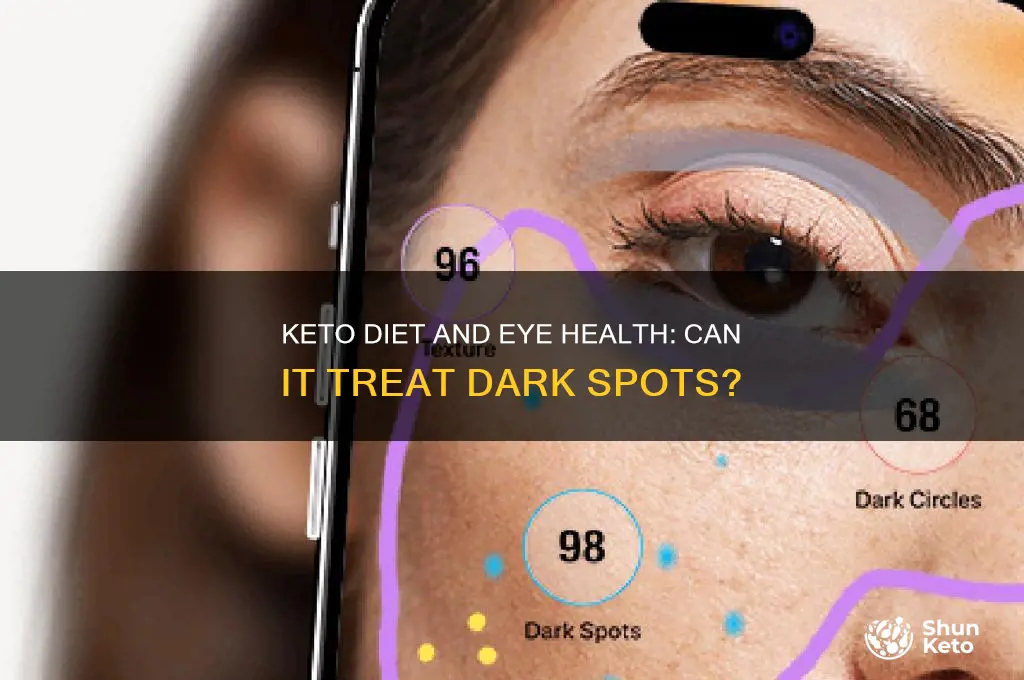 can keto treat dark spot in eyes