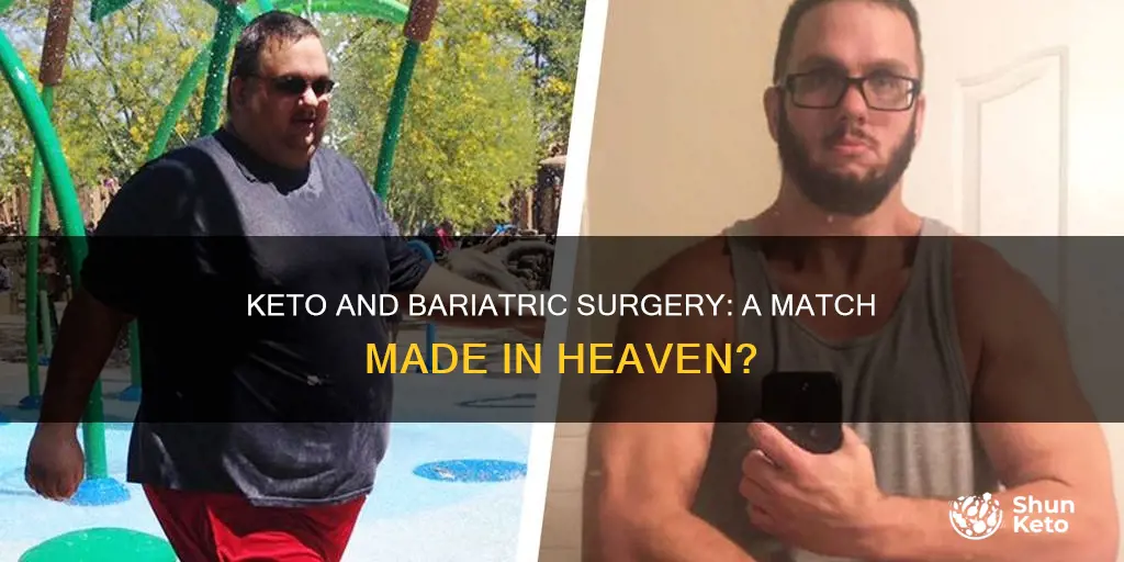 can keto work with someone who had bariatric surgery