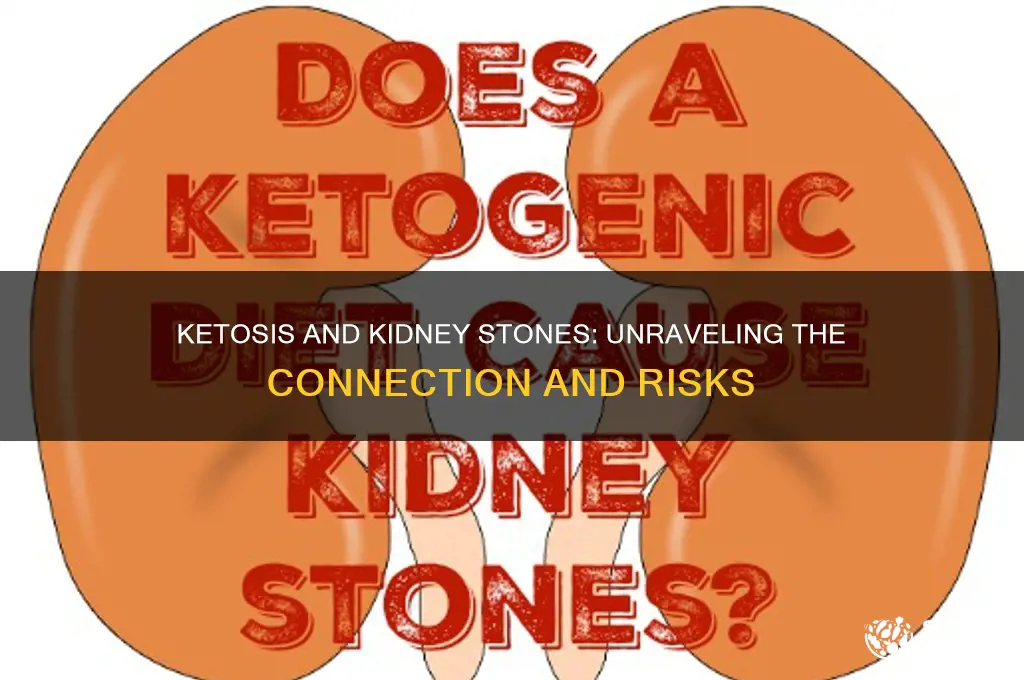 can ketosis cause kidney stones