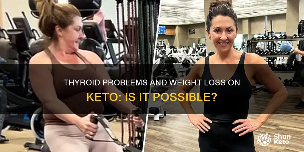 can people with thirod problems lose weight on keto