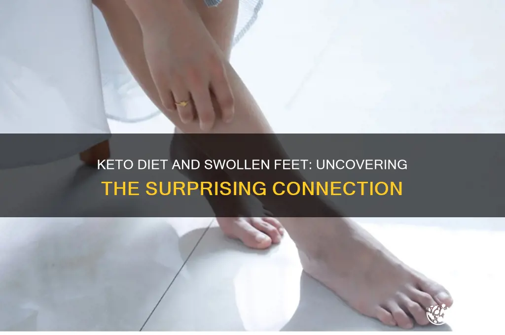 can the keto diet cause swollen feet