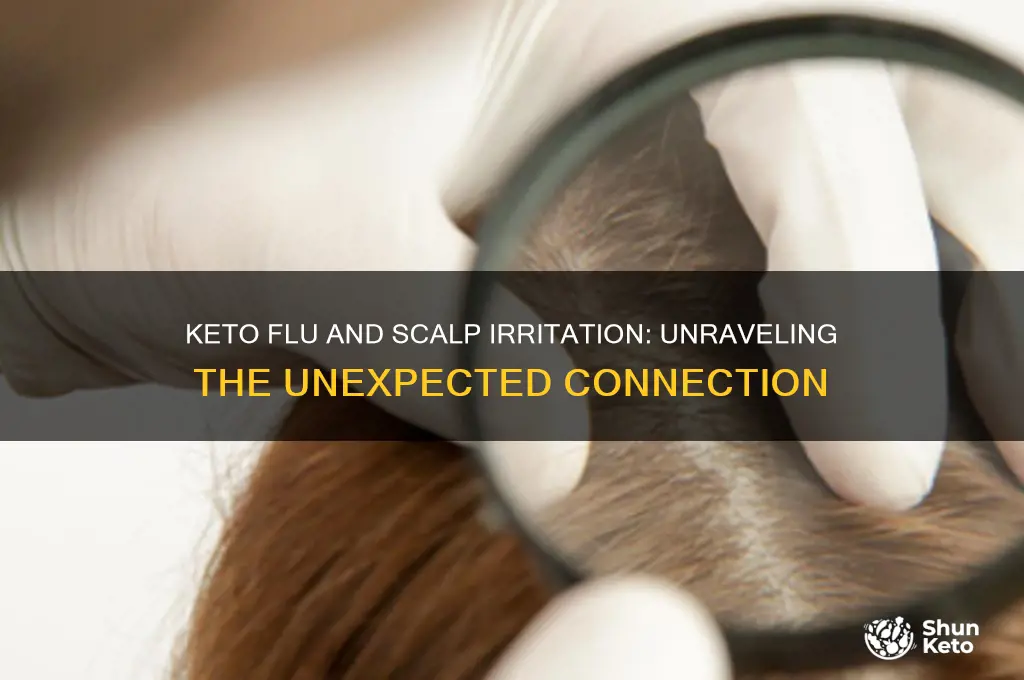 can the keto flu cause scalp irritation