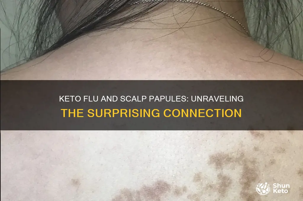 can the keto flu cause scalp papules