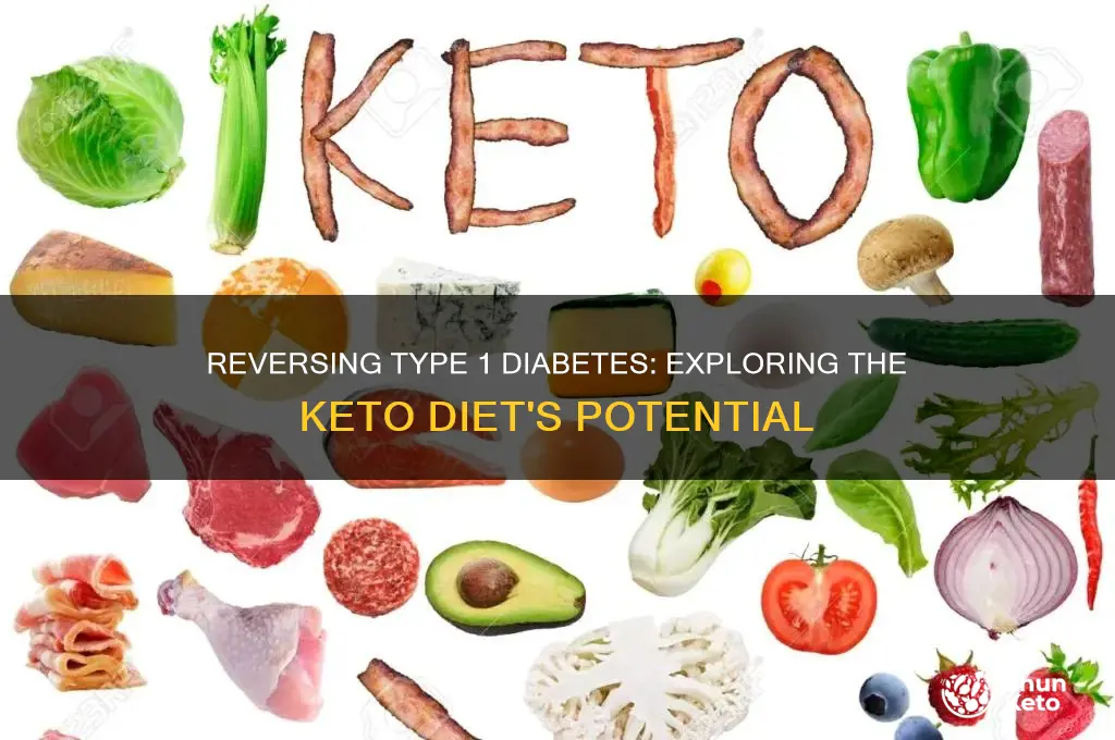 can type 1 diabetes be reversed with keto diet